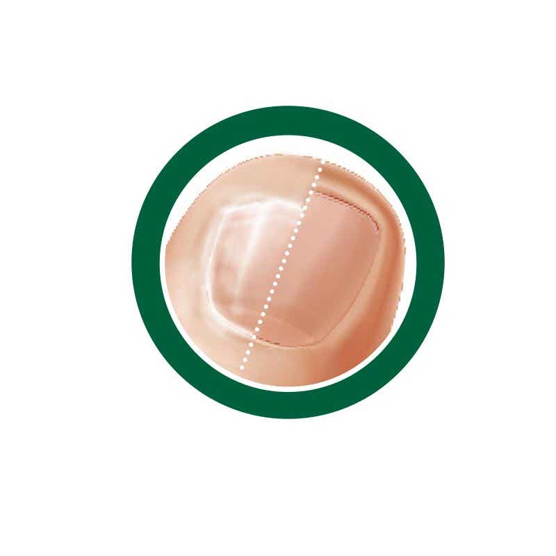 SERUM ONGLES ET CONTOURS STOP ONGLES RONGES 8ML